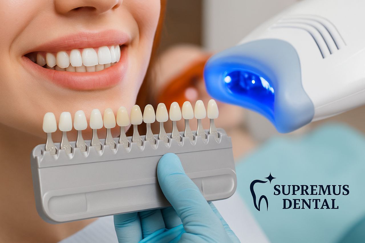 Blanqueamiento dental